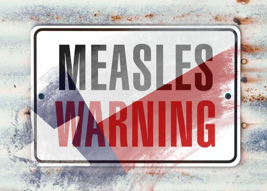 Callan Políticos ante Brote de sarampión en Texas