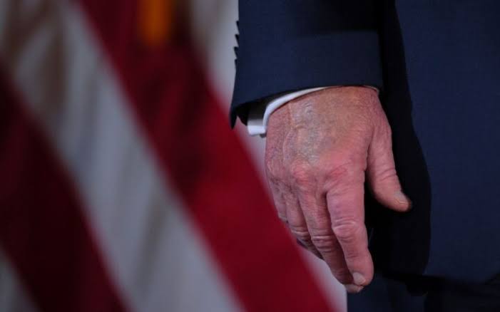Confirman insuficiencia en Donald Trump